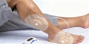 Negatif Basınç Tedavisi (VAC) Nedir?